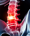 Acute Spinal Cord Injury: New Practice Guidelines