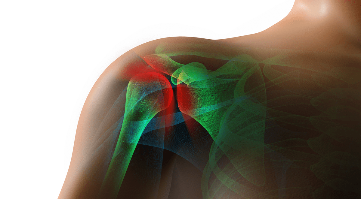 Shoulder pain linked to increased heart disease risk