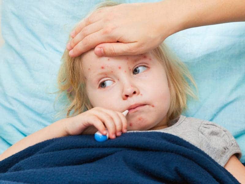 Some Cities in Texas Susceptible to Measles Outbreaks