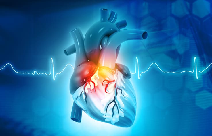 Heart Rhythm 2013: Bleeding Complications Reduced by Not Interrupting Warfarin in Cardiac Device Surgery