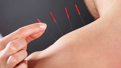 Acupuncture Aids Outcomes After Heart Valve Surgery