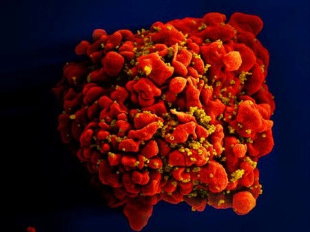 AIDS drugs prevent sexual transmission of HIV in gay men
